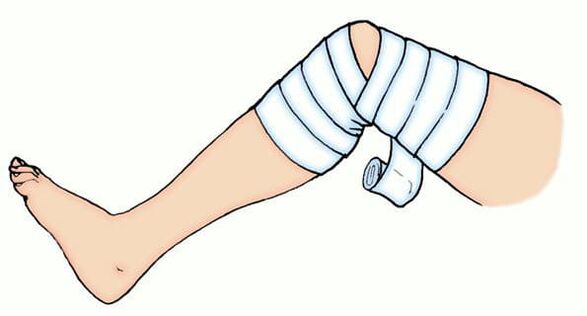 Bandage elastica